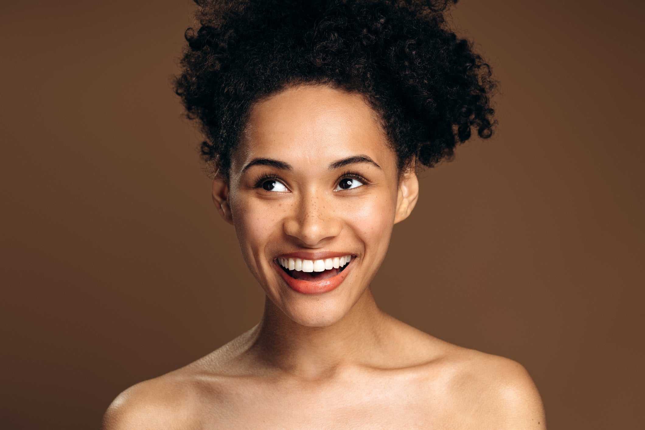 Acne - Skin Vitality Medical Clinic