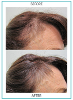 Hair Nourishment Supplements