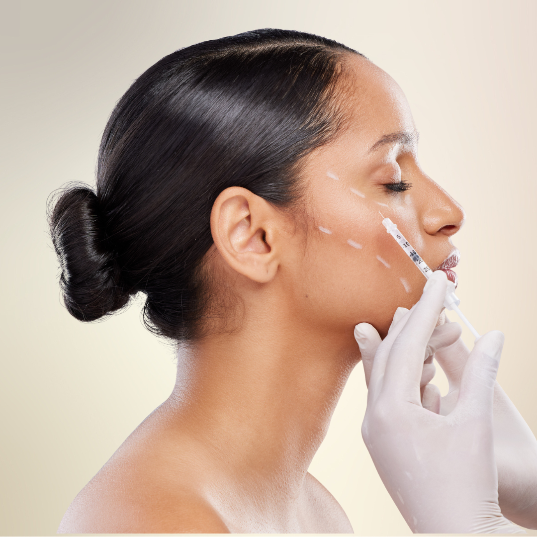 $500 Gift Certificate for 1 Juvederm Syringe