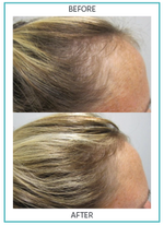 Hair Nourishment Supplements