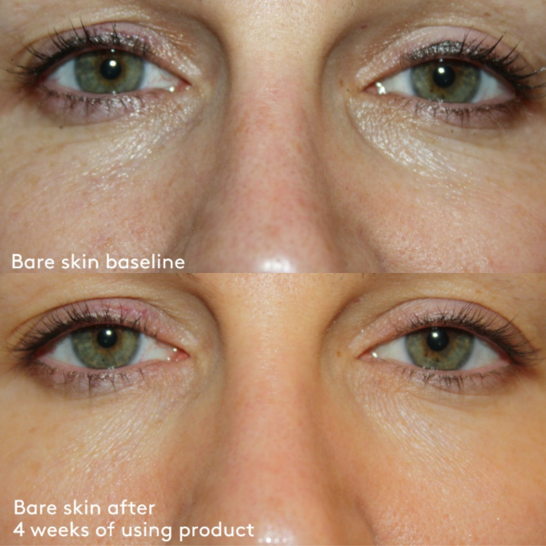 Total Eye 3-in-1 Renewal Therapy SPF 35