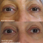 Total Eye 3-in-1 Renewal Therapy SPF 35