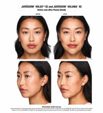 $500 Gift Certificate for 1 Juvederm Syringe