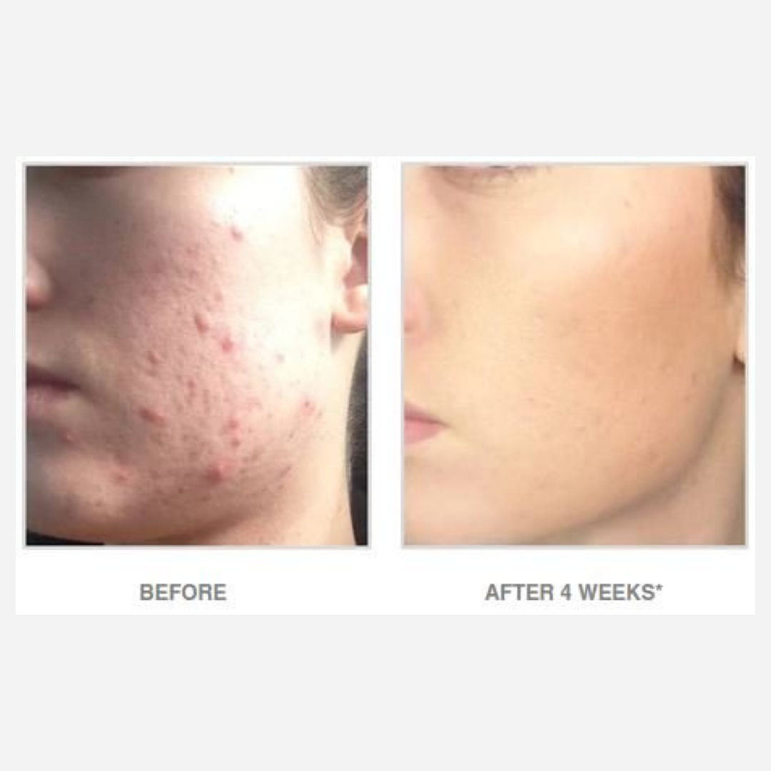 Vivier AHA/BHA Exfoliating Cream