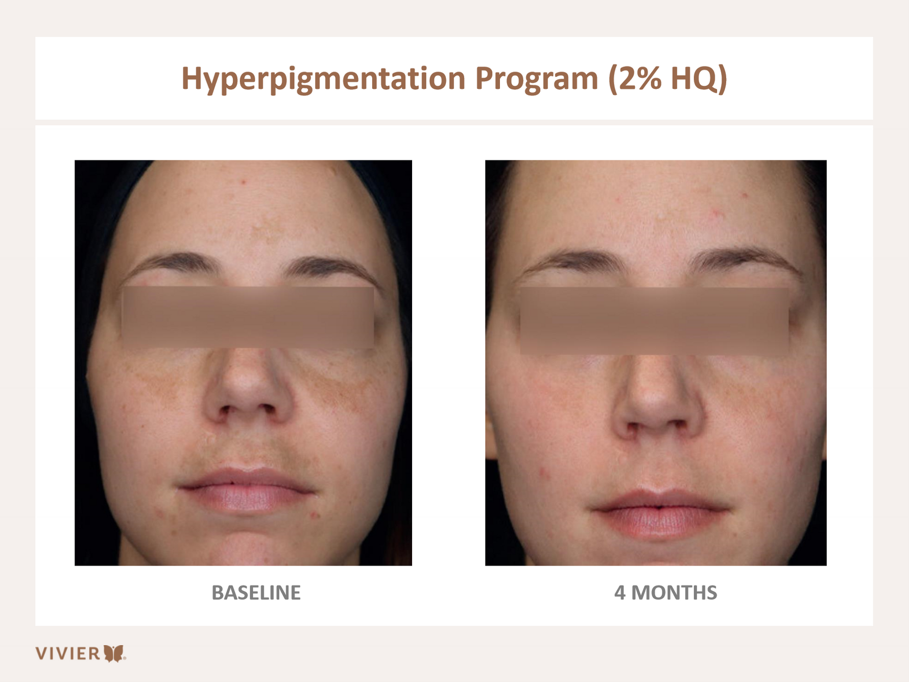 vivier skintx corrector 2