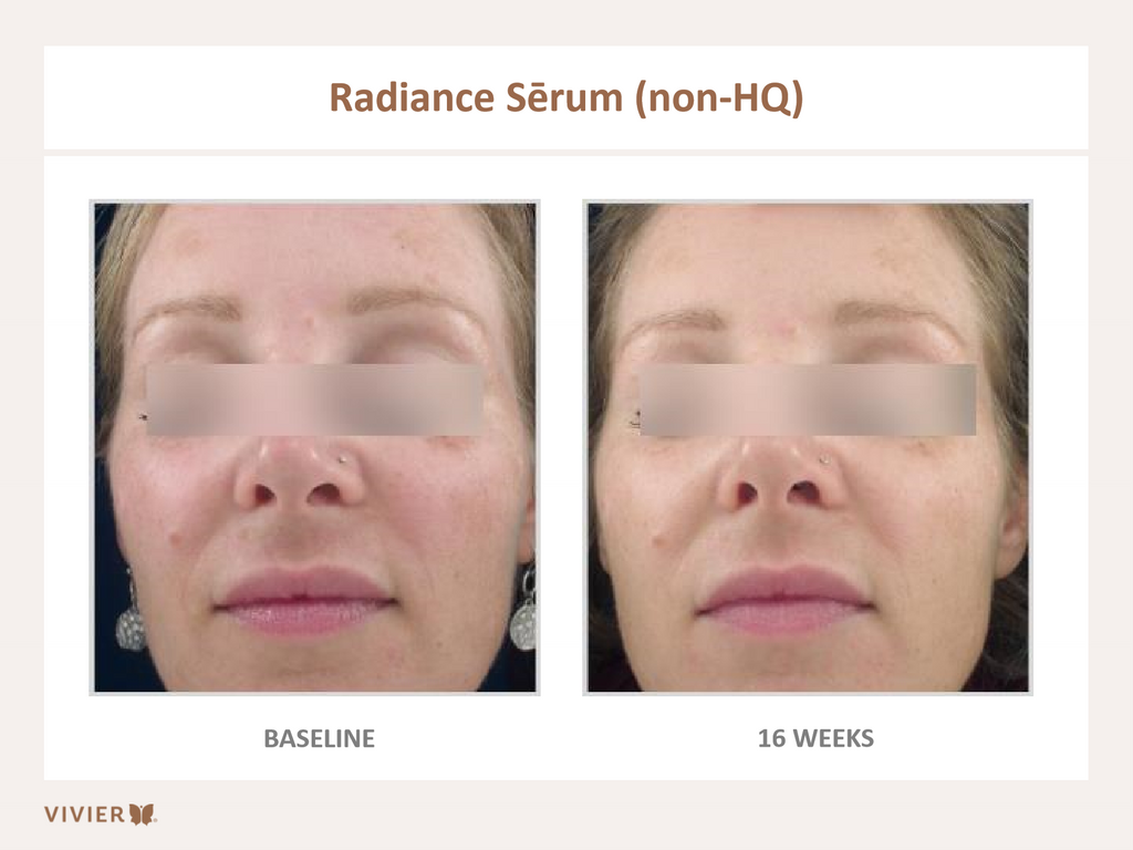 radiance serum before and after